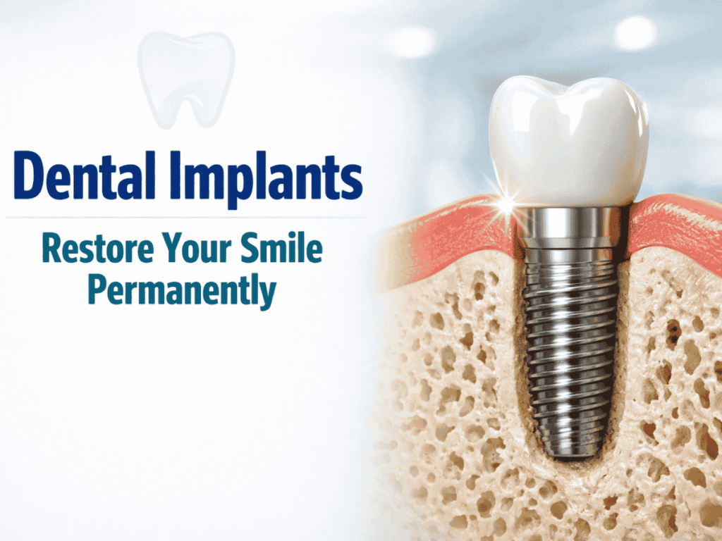 Dental Implants in Kanchipuram