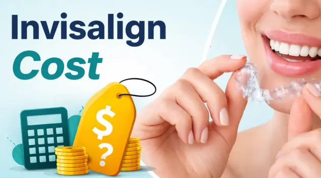 Invisalign Cost in Kanchipuram