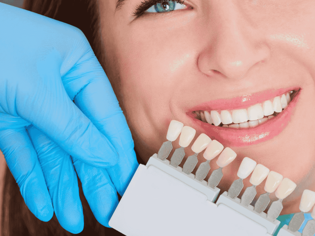 smile designing